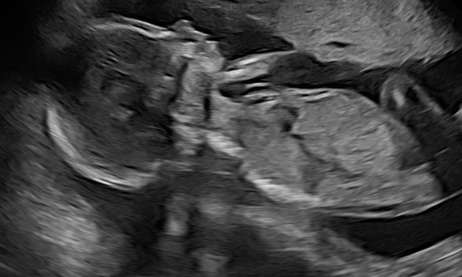 Redo för den stora dagen?