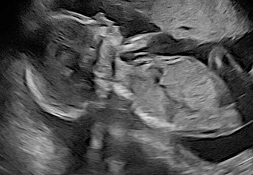 Redo för den stora dagen?